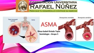 ASMA
Diosa Isabel Oviedo Tapia
Semiología – Grupo 5
 