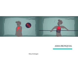 ASMA BRONQUIAL
Neumología
 
