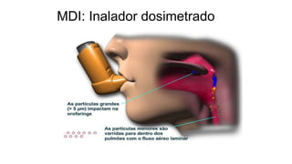 MDI: Inalador dosimetrado
 