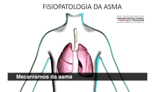 FISIOPATOLOGIA DA ASMA
 