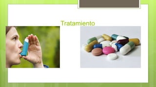 Tratamiento
 