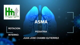 ASMA
ROTACION:
PEDIATRIA
INTERNO:
JUAN JOSE CHAMBI GUTIERREZ
 