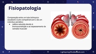 Fisiopatologia
Comparação entre um tubo brônquico
saudável e outro compatível com o de um
indivíduo asmático:
● calibre reduzido devido à
broncoconstrição e ao espessamento da
camada muscular
Lightspring/Shutterstock.com
 