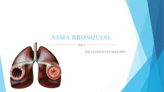 ASMA BRONQUIAL
DR. GONZALO PAGLIARO
 