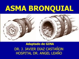 ASMA BRONQUIAL Adaptado de GINA DR. J. JAVIER DIAZ CASTAÑON HOSPITAL DR. ANGEL LEAÑO 