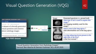 Visual Question Generation (VQG)
“Visual Question Generation from Radiology Images”.
Sarrouti, Ben Abacha & Demner-Fushman. ACL-ALVR 2020.
42
VQA-RAD dataset
 