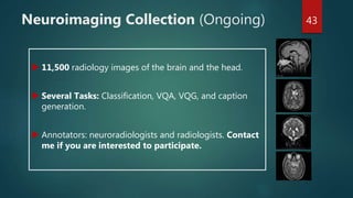 Neuroimaging Collection (Ongoing)
 11,500 radiology images of the brain and the head.
 Several Tasks: Classification, VQA, VQG, and caption
generation.
 Annotators: neuroradiologists and radiologists. Contact
me if you are interested to participate.
43
 