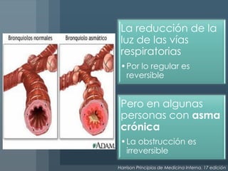La reducción de la
 luz de las vías
 respiratorias
 •Por lo regular es
  reversible


 Pero en algunas
 personas con asma
 crónica
 •La obstrucción es
  irreversible
Harrison Principios de Medicina Interna. 17 edición
 