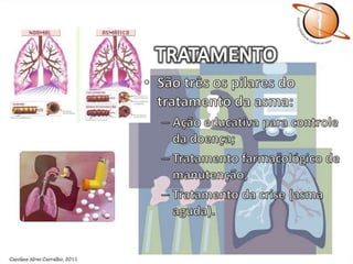 TRATAMENTOSão três os pilares do tratamento da asma:Ação educativa para controle da doença;Tratamento farmacológico de manutenção;Tratamento da crise (asma aguda).