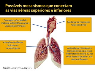 Possíveismecanismosqueconectamas viasaéreassuperiores e inferioresDrenagempós-nasal de material inflamatóriopara as viasaéreasinferioresMudançadarespiração nasal pelabucalAtivação de reflexosbrônquicosnasofaríngeosAbsorção de mediadoresprovenientes do processoinflamatório no narizounosseiosparanasaispelasviasaéreasinferioresTogias AG. Allergy. 1999;54:S94-S105.