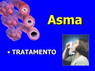 Asma TRATAMENTO 
