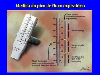 Medida do pico de fluxo expiratório 
