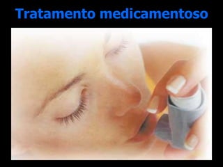 Tratamento medicamentoso 