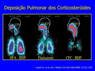 Deposição Pulmonar dos Corticosteróides Leach CL  et al. Am J Respir Crit Care Med  2000; 16 (3): A34 (mesmo paciente) 
