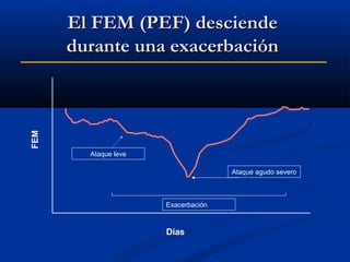 FEM

El FEM (PEF) desciende
durante una exacerbación

Ataque leve
Ataque agudo severo

Exacerbación

Días

 