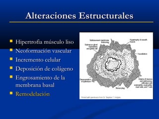 Alteraciones Estructurales








Hipertrofia músculo liso
Neoformación vascular
Incremento celular
Deposición de colágeno
Engrosamiento de la
membrana basal
Remodelación

 