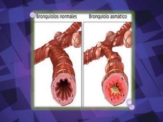 Ejercicios, llanto, risa