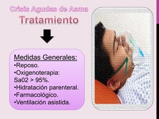 Medidas Generales:
•Reposo.
•Oxigenoterapia:
Sa02 > 95%.
•Hidratación parenteral.
•Farmacológico.
•Ventilación asistida.
 