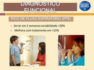 


Seriar em 2 semanas:variabilidade >20%
Melhora com tratamento em >15%

 