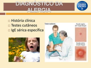 História clínica
 Testes cutâneos
 IgE sérica específica


 