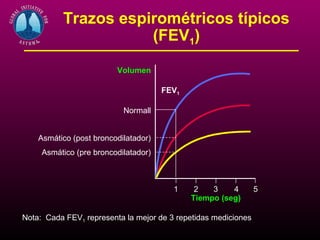 Trazos espirométricos típicos
                     (FEV1)

                         Volumen

                                      FEV1

                           Normall


    Asmático (post broncodilatador)
     Asmático (pre broncodilatador)



                                        1     2   3    4        5
                                             Tiempo (seg)

Nota: Cada FEV1 representa la mejor de 3 repetidas mediciones
 