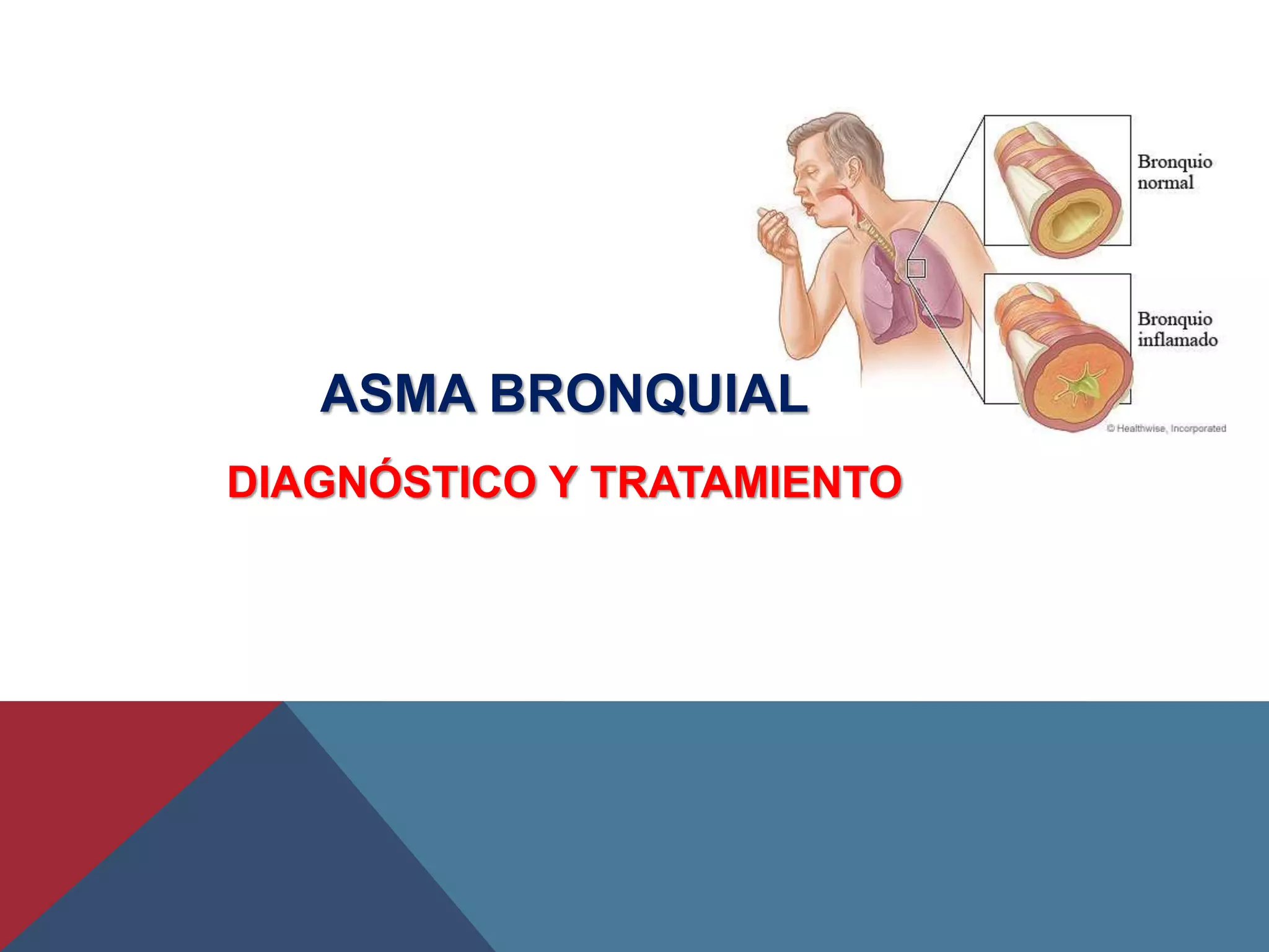 Asma bronquial | PPTX