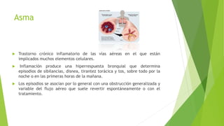 Asma Bronquial PPTX asma-bronquial-pptx