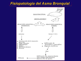 Quadro clínico de doenças asma bronquial.ppt