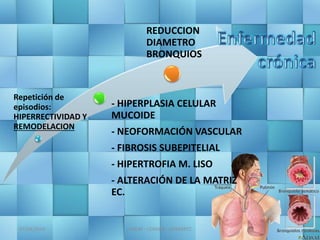 07/04/2016 JMGM - CEMAIN - GOMARTZ
Repetición de
episodios:
HIPERRECTIVIDAD Y
REMODELACION
- HIPERPLASIA CELULAR
MUCOIDE
- NEOFORMACIÓN VASCULAR
- FIBROSIS SUBEPITELIAL
- HIPERTROFIA M. LISO
- ALTERACIÓN DE LA MATRIZ
EC.
REDUCCION
DIAMETRO
BRONQUIOS
 