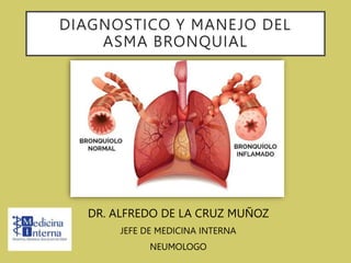 DIAGNOSTICO Y MANEJO DEL
ASMA BRONQUIAL
DR. ALFREDO DE LA CRUZ MUÑOZ
JEFE DE MEDICINA INTERNA
NEUMOLOGO
 