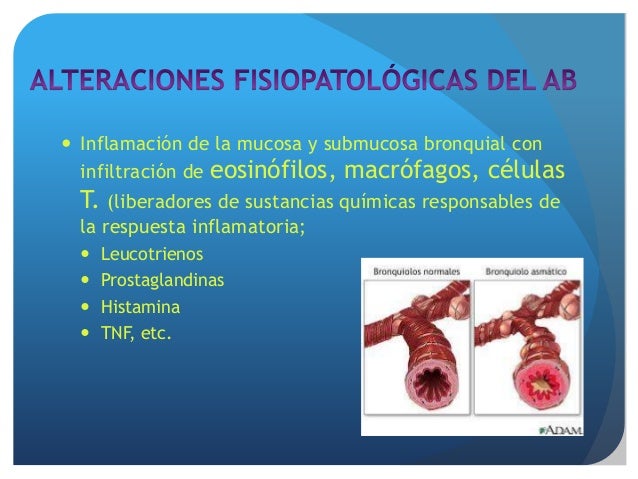 Tratamiento farmacológico del asma Tratamiento farmacológico del asma