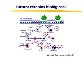 Futuro: terapias biológicas?

Wenzel. Ann Intern Med 2010

 
