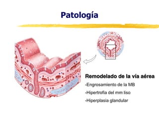 Patología

Remodelado de la vía aérea
-Engrosamiento de la MB
-Hipertrofia del mm liso
-Hiperplasia glandular

 