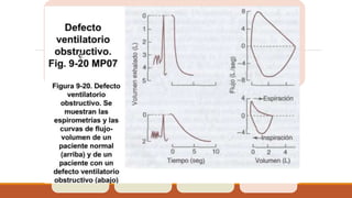 la presencia de
falta de
coordinación V/Q
creciente con
obstrucción de la
vía respiratoria
produce regiones
de índice V/Q bajo
En los ataques
intensos, la
obstrucción de la
vía respiratoria
persiste o se
incrementa y
sobreviene la
fatiga muscular,
con el desarrollo
de hipo-ventilación
alveolar
se presenta el
vaciado
incompleto de las
unidades
pulmonares al final
de la espiración y
provoca la
hiperinflación
aguda y crónica.
la tendencia del
árbol bronquial a
una repuesta
broncoconstrictora
excesiva frente a
estímulos , como
pueden ser las
sustancias
alérgicas.
 