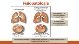 La inflamación y la
hiperreactividad del
músculo liso
Incremento de la
resistencia de las vías
respiratorias
produce
La hipersecreción de moco y los estímulos broncoconstrictores pueden exacerbar la
fisiología pulmonar obstructiva
 
