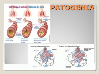 PATOGENIAPATOGENIA
 