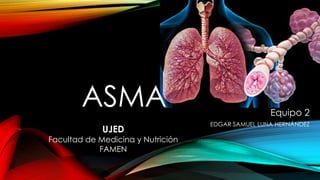 ASMA 
Equipo 2 
EDGAR SAMUEL LUNA HERNÁNDEZ 
UJED 
Facultad de Medicina y Nutrición 
FAMEN 
 