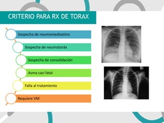 CRITERIO PARA RX DE TORAX
Sospecha de neumomediastino
Sospecha de neumotoráx
Sospecha de consolidación
Asma casi fatal
Falla al tratamiento
Requiere VM
 