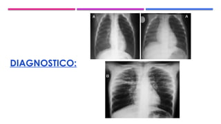 DIAGNOSTICO:
 