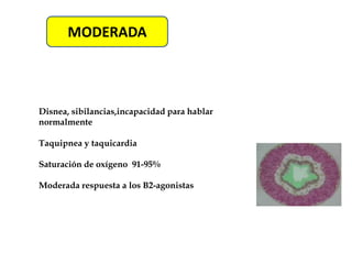 Tratamiento del Asma