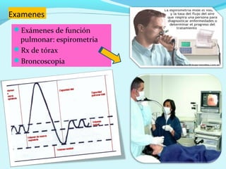 Examenes
 Exámenes de función
  pulmonar: espirometria
 Rx de tórax
 Broncoscopia
 
