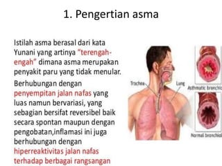 1. Pengertian asma
 