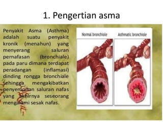 1. Pengertian asma
 