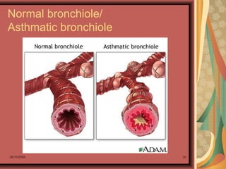 26/10/2009 30
Normal bronchiole/
Asthmatic bronchiole
 