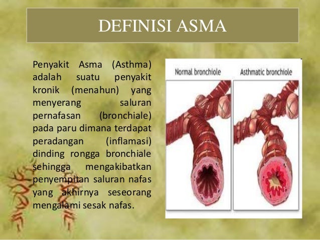 Cetosis para asma