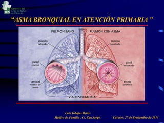 Gerencia del
Área de Salud
de Cáceres

“ASMA BRONQUIAL EN ATENCIÓN PRIMARIA ”

Luis Tobajas Belvís
Medico de Familia . Cs. San Jorge

Cáceres, 27 de Septiembre de 2013

 