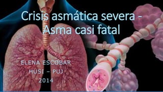Crisis asmática severa -
Asma casi fatal
ELENA ESCOBAR
HUSI – PUJ
2014
 