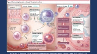 McCracken, J., Sreenivas, P. Et al. Diagnosis and Management of Asthma in Adults, A Review. JAMA. 2017;318(3):279-290
 