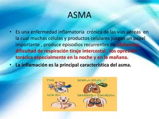 Asma y alveolitis alérgica
