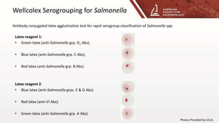 Wellcolex Serogrouping for Salmonella
Antibody conjugated latex agglutination test for rapid serogroup classification of Salmonella spp.
Latex reagent 1:
• Green latex (anti-Salmonella grp. D1 Abs).
• Blue latex (anti-Salmonella grp. C Abs).
• Red latex (anti-Salmonella grp. B Abs).
Latex reagent 2:
• Blue latex (anti-Salmonella grps. E & G Abs).
• Red latex (anti-Vi Abs).
• Green latex (anti-Salmonella grp. A Abs).
Photos Provided by UCLA.
 